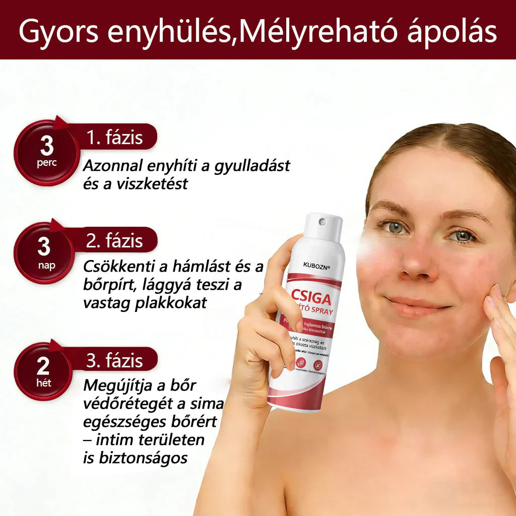 KUBOZN®  csigahéjas spray viszkető, hámló pikkelysömörös bőrre