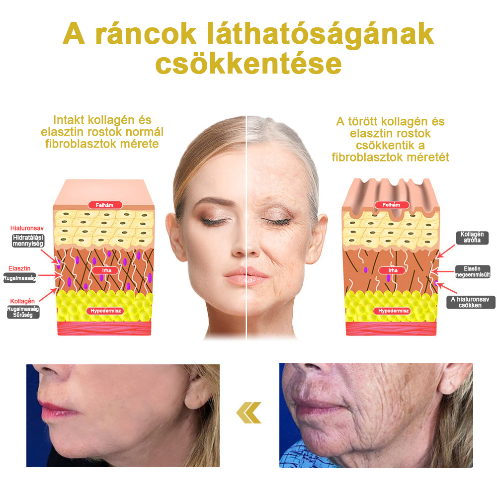 3 egymást követő év Readers’ Choice díjnyertes Moondar™ feszesítő krém – visszaadja a bőr rugalmasságát és fiatalos ragyogását 🏆