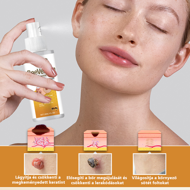 Pureluxo® BeeVenom Szemölcs Megújító Spray