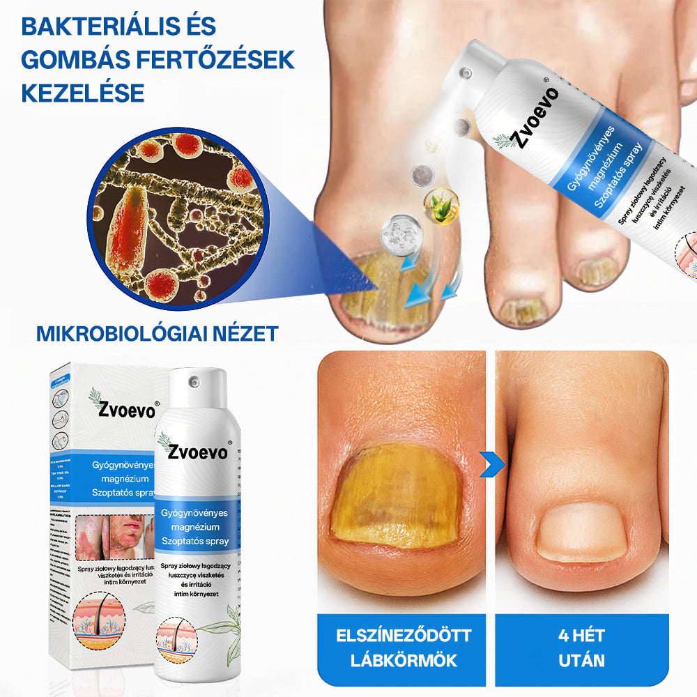 Hivatalos bolt: Zvoevo® Magnéziumos gyógynövényes spray pikkelysömörre ⚕️ MHRA tanúsítvánnyal (enyhíti a pikkelysömört, ekcémát, kezeli pattanásokat, szemölcsöket, javítja bakteriális fertőzéseket)