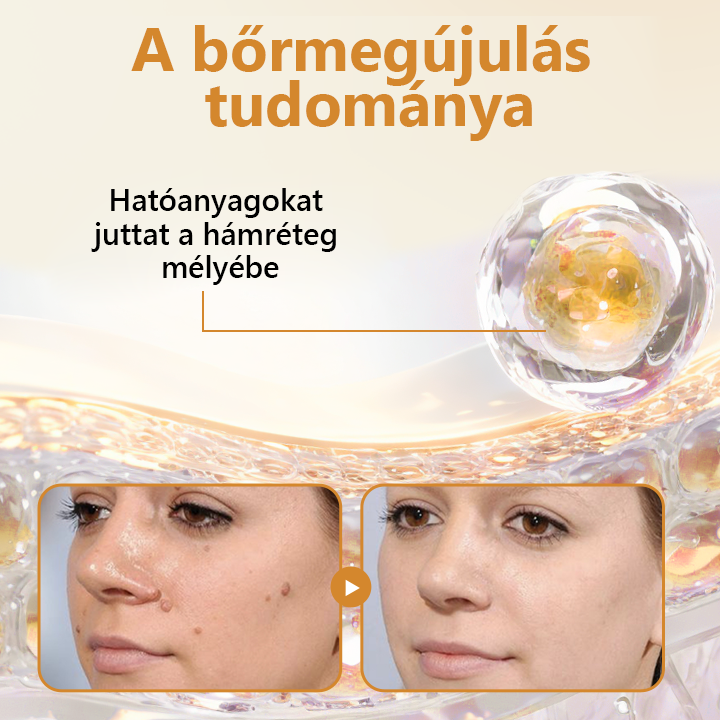 Pureluxo® BeeVenom Szemölcs Megújító Spray