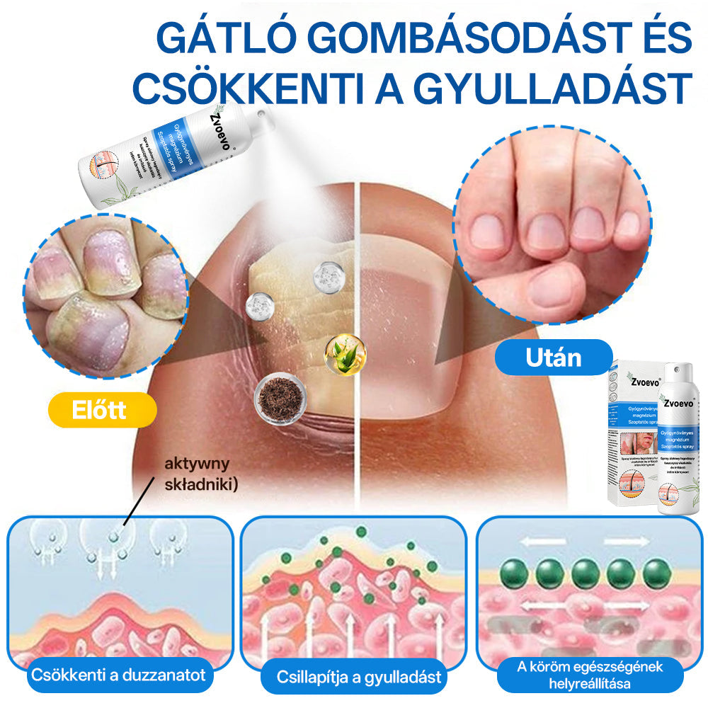 Hivatalos bolt: Zvoevo® Magnéziumos gyógynövényes spray pikkelysömörre ⚕️ MHRA tanúsítvánnyal (enyhíti a pikkelysömört, ekcémát, kezeli pattanásokat, szemölcsöket, javítja bakteriális fertőzéseket)