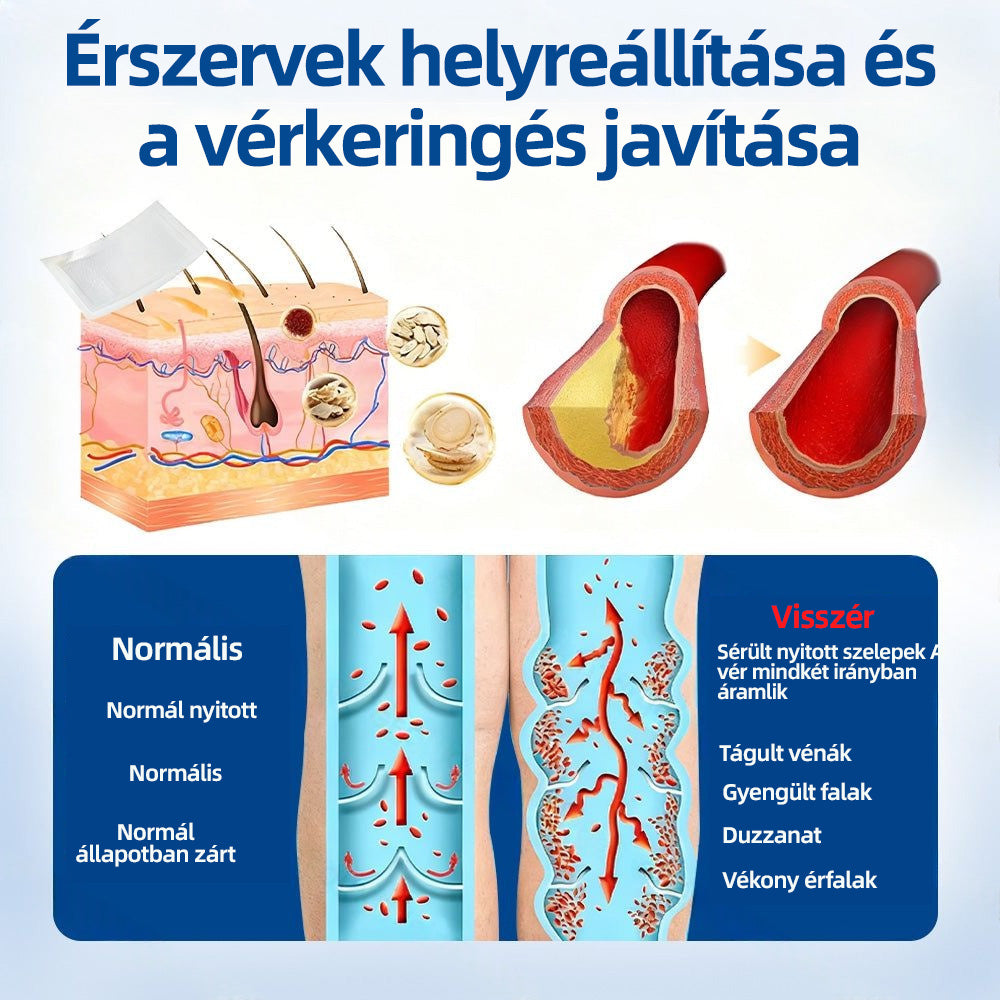 Healrize® Vénacélpont mikrotűs tapasz⚡Azonnali enyhülés hosszú távú eredmények